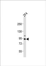 RRM1 Polyclonal Antibody