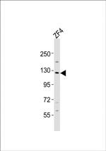 LOK Antibody in Western Blot (WB)