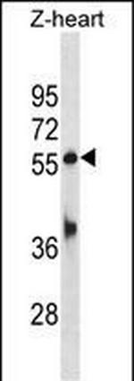 TEAD1B Polyclonal Antibody