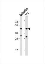 PDHA1A Antibody in Western Blot (WB)