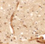KCNK13 Polyclonal Antibody