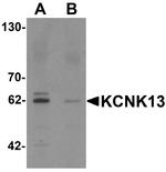 KCNK13 Antibody in Western Blot (WB)