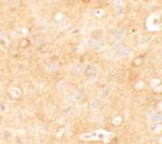 KCNK12 Polyclonal Antibody