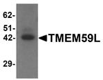 TMEM59L Antibody in Western Blot (WB)