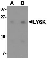 LY6K Polyclonal Antibody