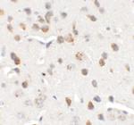CHD7 Polyclonal Antibody
