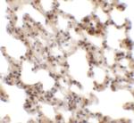 Coronin 7 Polyclonal Antibody