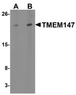 TMEM147 Polyclonal Antibody