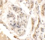 KIAA0701 Polyclonal Antibody