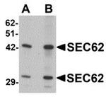 SEC62 Antibody in Western Blot (WB)