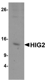 HIGD2A Polyclonal Antibody