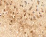 Draxin Polyclonal Antibody