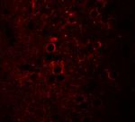 NSRP1 Polyclonal Antibody