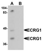TMPRSS11A Polyclonal Antibody