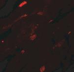 TGM5 Antibody in Immunohistochemistry (Paraffin) (IHC (P))