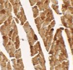 TGM5 Polyclonal Antibody