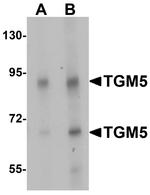 TGM5 Antibody in Western Blot (WB)