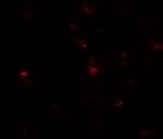 TGM7 Antibody in Immunocytochemistry (ICC/IF)