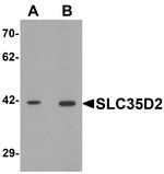 SLC35D2 Antibody in Western Blot (WB)