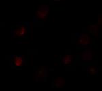 SLC35D3 Antibody in Immunocytochemistry (ICC/IF)