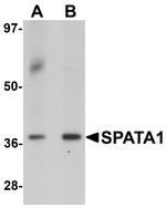 SPATA1 Antibody in Western Blot (WB)