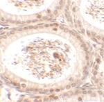 SPATA3 Polyclonal Antibody