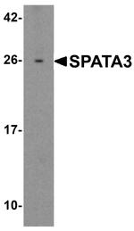 SPATA3 Antibody in Western Blot (WB)