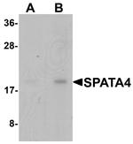 SPATA4 Antibody in Western Blot (WB)
