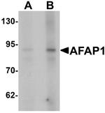 AFAP Polyclonal Antibody