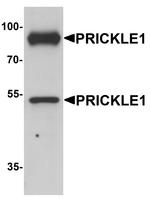 PRICKLE1 Polyclonal Antibody
