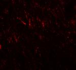 PRICKLE2 Antibody in Immunocytochemistry (ICC/IF)