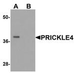 PRICKLE4 Antibody in Western Blot (WB)