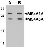 MS4A6A Antibody in Western Blot (WB)