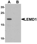 LEMD1 Polyclonal Antibody