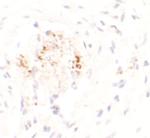 MAN1 Polyclonal Antibody