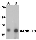 ANKLE1 Polyclonal Antibody
