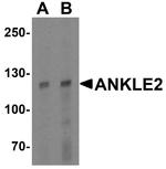 ANKLE2 Antibody in Western Blot (WB)