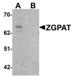 ZGPAT Antibody in Western Blot (WB)