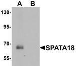 SPATA18 Antibody in Western Blot (WB)
