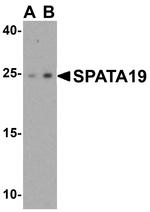 SPATA19 Polyclonal Antibody