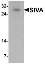 SIVA1 Antibody in Western Blot (WB)