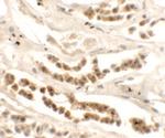 DISP1 Polyclonal Antibody