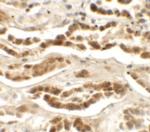LZTS2 Polyclonal Antibody