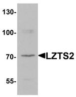 LZTS2 Antibody in Western Blot (WB)