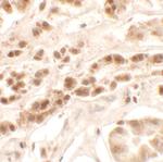 PTCHD2 Polyclonal Antibody