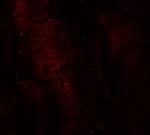 MEX3B Antibody in Immunocytochemistry (ICC/IF)