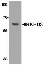 MEX3B Antibody in Western Blot (WB)