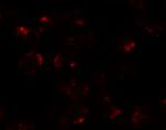 KPNA5 Antibody in Immunocytochemistry (ICC/IF)