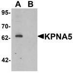 KPNA5 Antibody in Western Blot (WB)