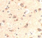 RUSC2 Polyclonal Antibody